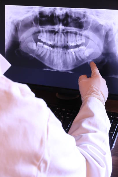 Best Emergency Gum Treatment in Ashland, NJ